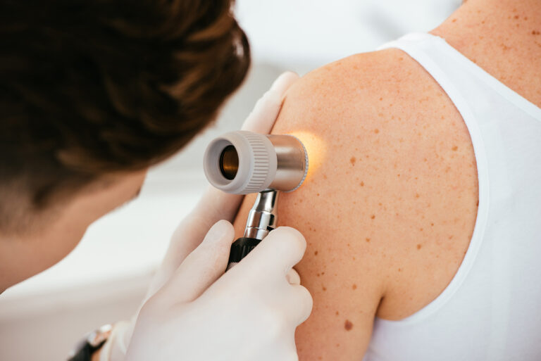 What to Expect During a Skin Cancer Check in Perth