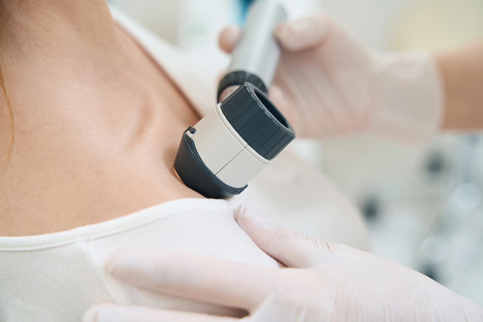 The Role of Dermatoscopy in Skin Cancer Detection: My Experience in Perth, Western Australia