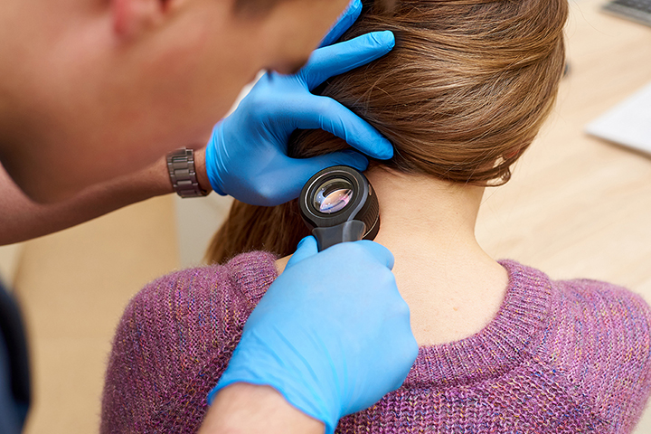 Understanding the Different Types of Skin Cancer: A Guide for Perth Residents