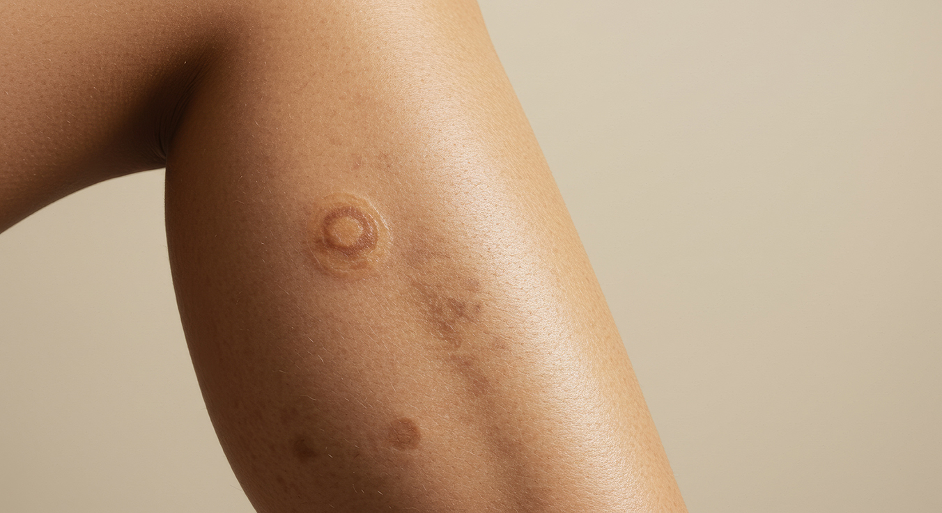 Toxins, Scars and Syndromes: The Hidden Triggers of Skin Cancer